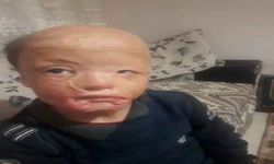 Halil için Türkiye tek yürek oldu