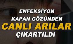 Hayatının Şokunu Yaşadı! Enfeksiyon kapan gözünden canlı arılar çıkarıldı