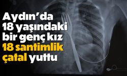 Aydın'da 18 yaşındaki bir genç kız, 18 santimlik çatal yuttu