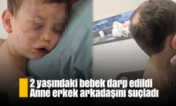 2 yaşındaki bebek darp edildi: Anne erkek arkadaşını suçladı