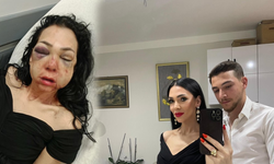 Oğlunun gözü önünde anneyi öldüresiye dövdüler