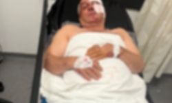 Aydın'da kan donduran olay: Husumetli olduğu kardeşine çarptı