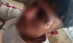 'Yuh artık' dedirten olay: Öğretmen öğrencinin burnunu kırdı