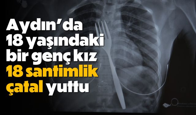 Aydın'da 18 yaşındaki bir genç kız, 18 santimlik çatal yuttu