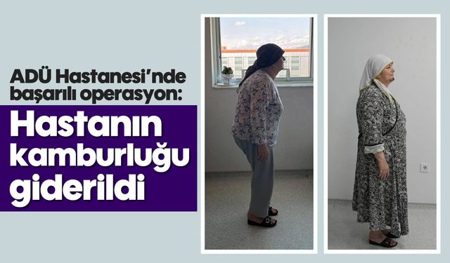 ADÜ Hastanesi’nde başarılı operasyon: Hastanın kamburluğu giderildi
