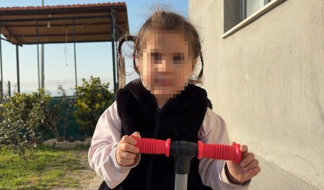 Köpek dehşeti: 3 yaşındaki Ada'nın yüzü bu hale geldi