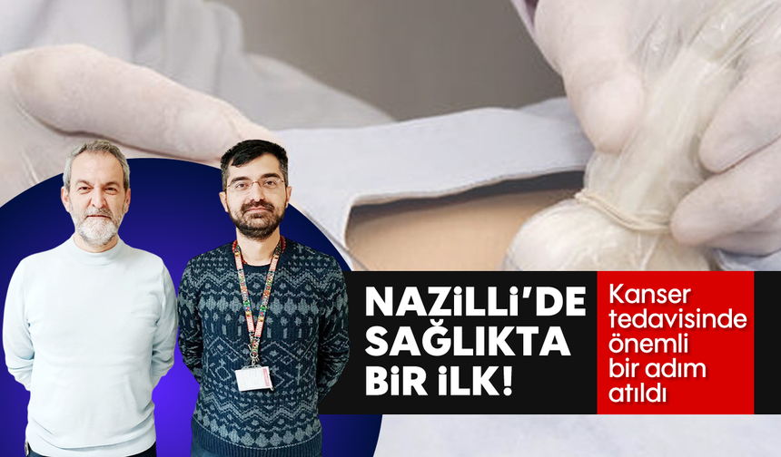 Nazilli'de sağlıkta bir ilk: Kanser tedavisinde önemli bir adım atıldı