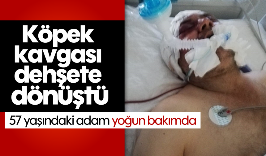Köpek kavgası dehşete dönüştü: 57 yaşındaki adam yoğun bakımda