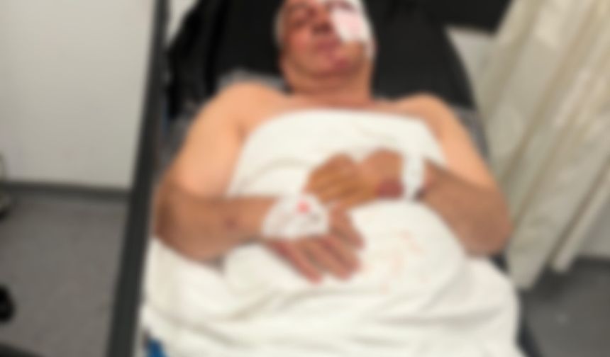 Aydın'da kan donduran olay: Husumetli olduğu kardeşine çarptı