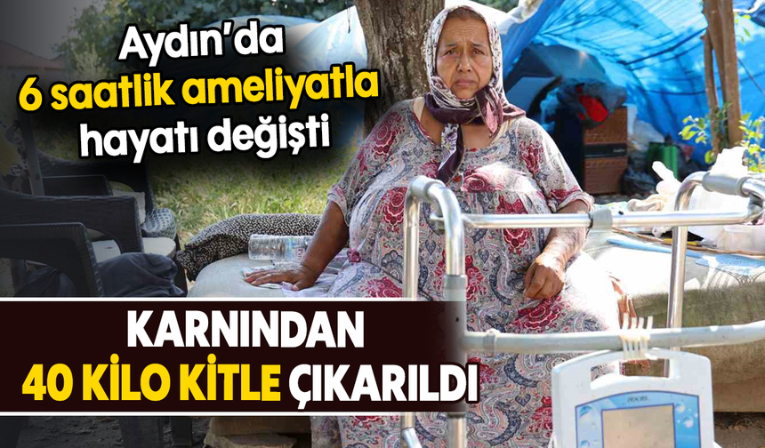 Aydın’da 6 saatlik ameliyatla hayatı değişti: Karnından 40 kilo kitle çıkarıldı