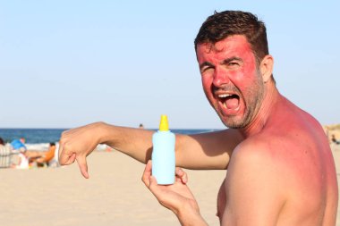 Depositphotos 335586948 Stock Photo Man Getting Sunburned Beach