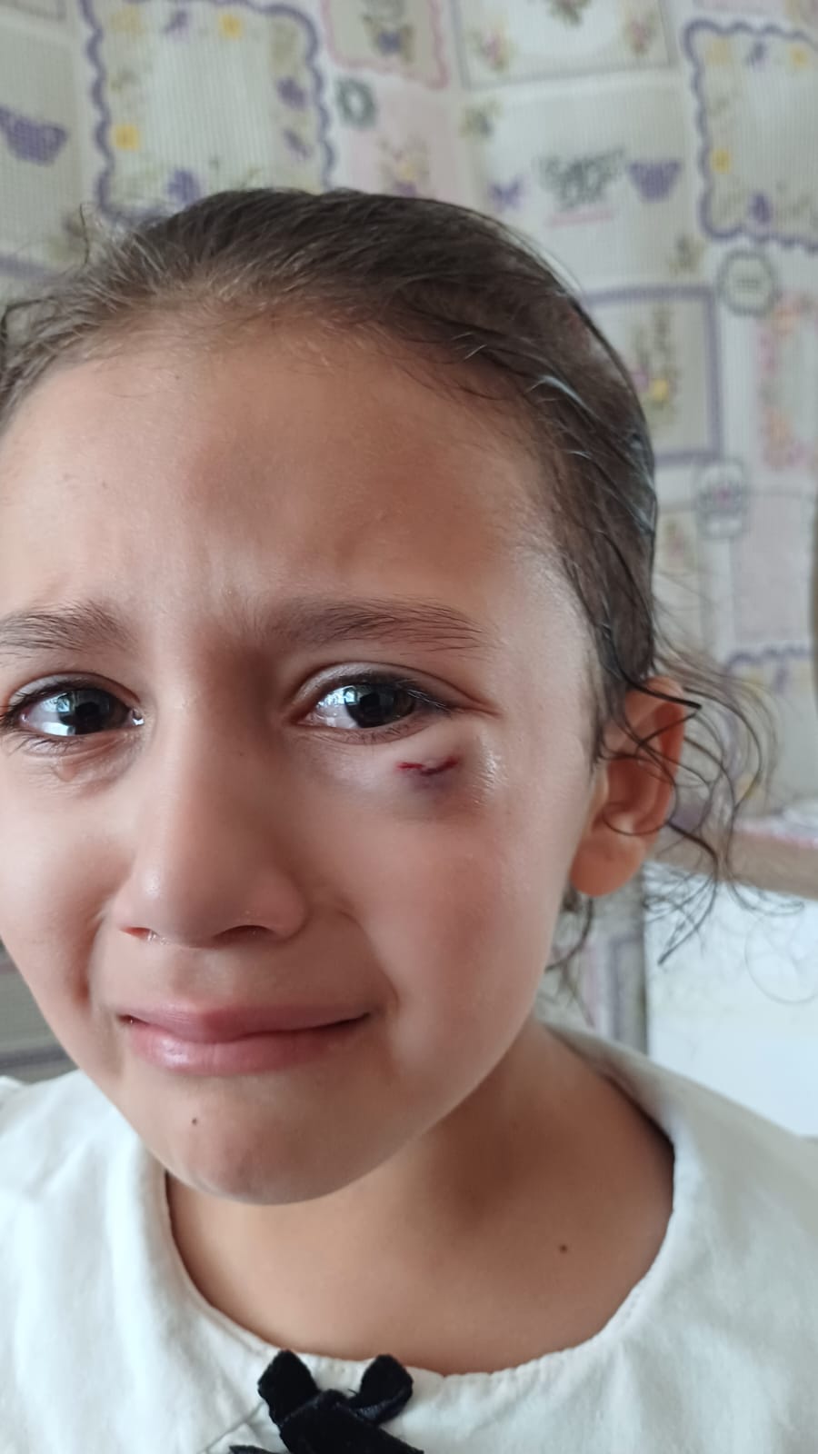 Koskte Talihsiz Kaza Defne Gozunu Kaybediyordu 612543 5956D44F05257012Ee1715E1639A2F20