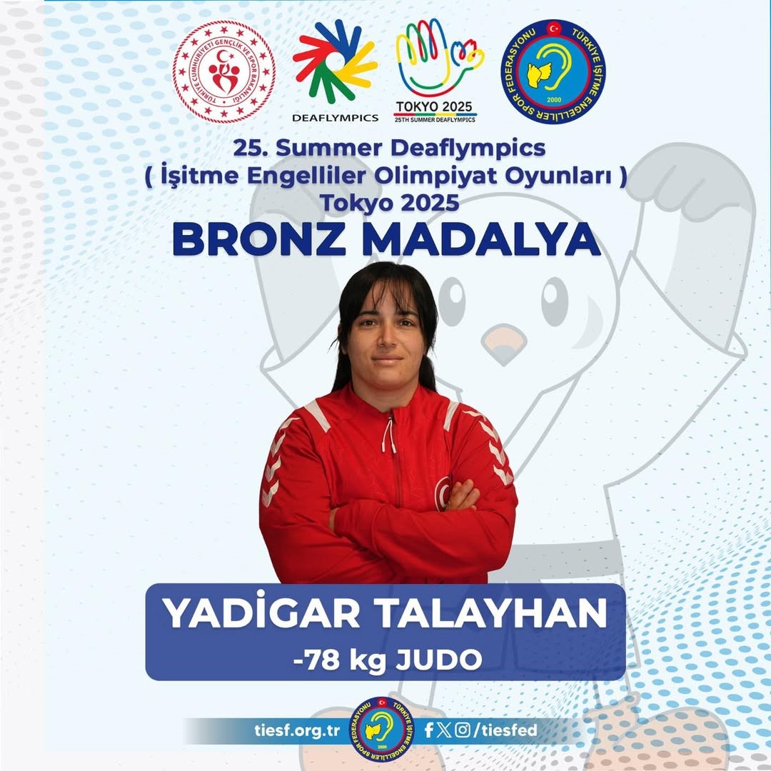 Sokeye Bir Gurur Daha Yasatti D9Fdc67780C7D07B7E920012B39Cc55E