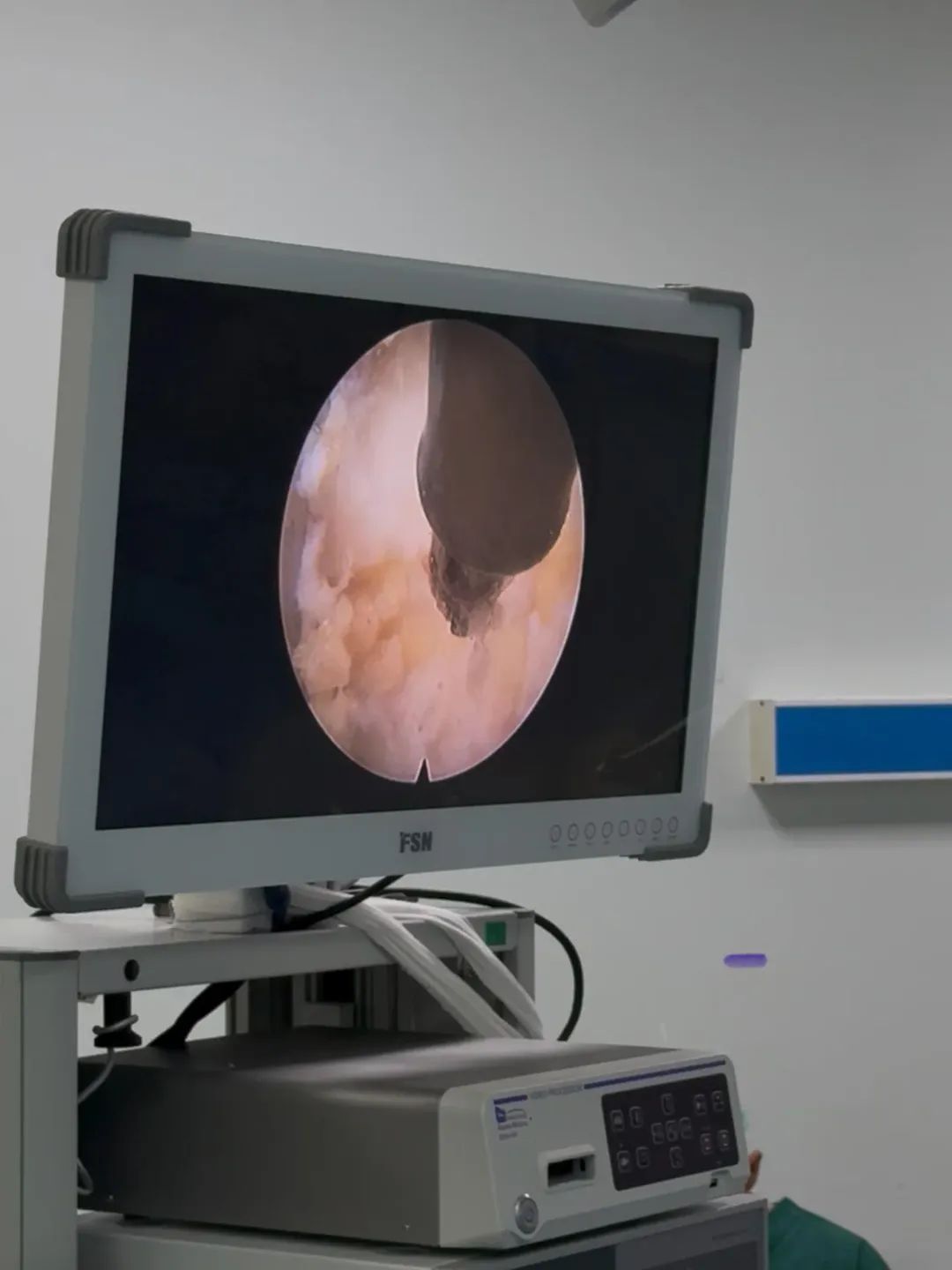 Aydinda Bir Ilk 627561 9C6D12E6F770808C059D307Adafa2053