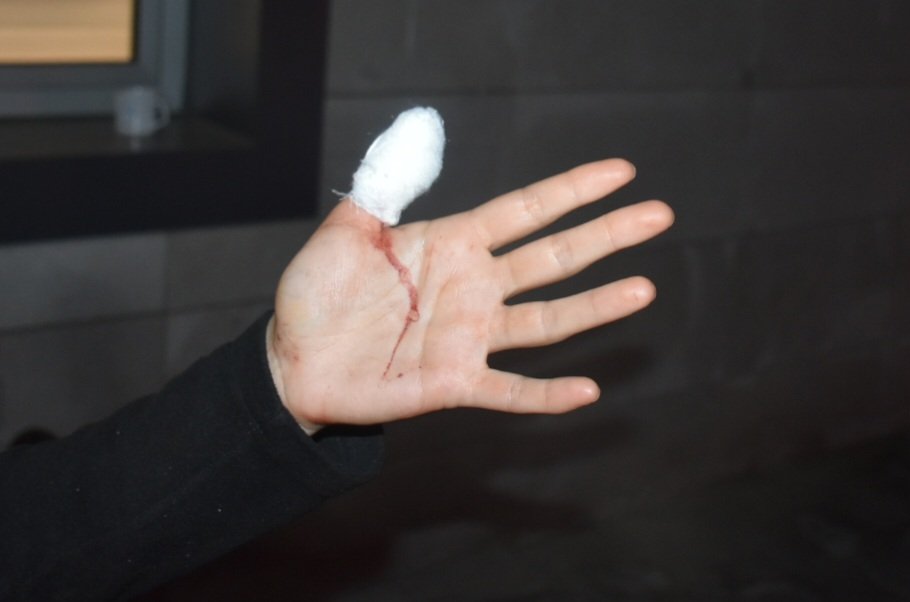 Karacasuda Kopek Dehseti Cocuklari Koruyan Anne Kendi Yarala 655289 B2B04C