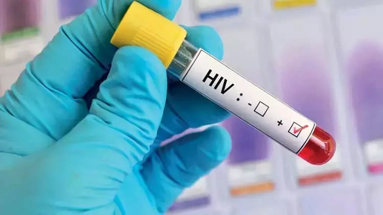 Aydinda Hiv Vakalarinda Dikkat Ceken Artis Uzmanindan Uyari 686721 Ce08Dd