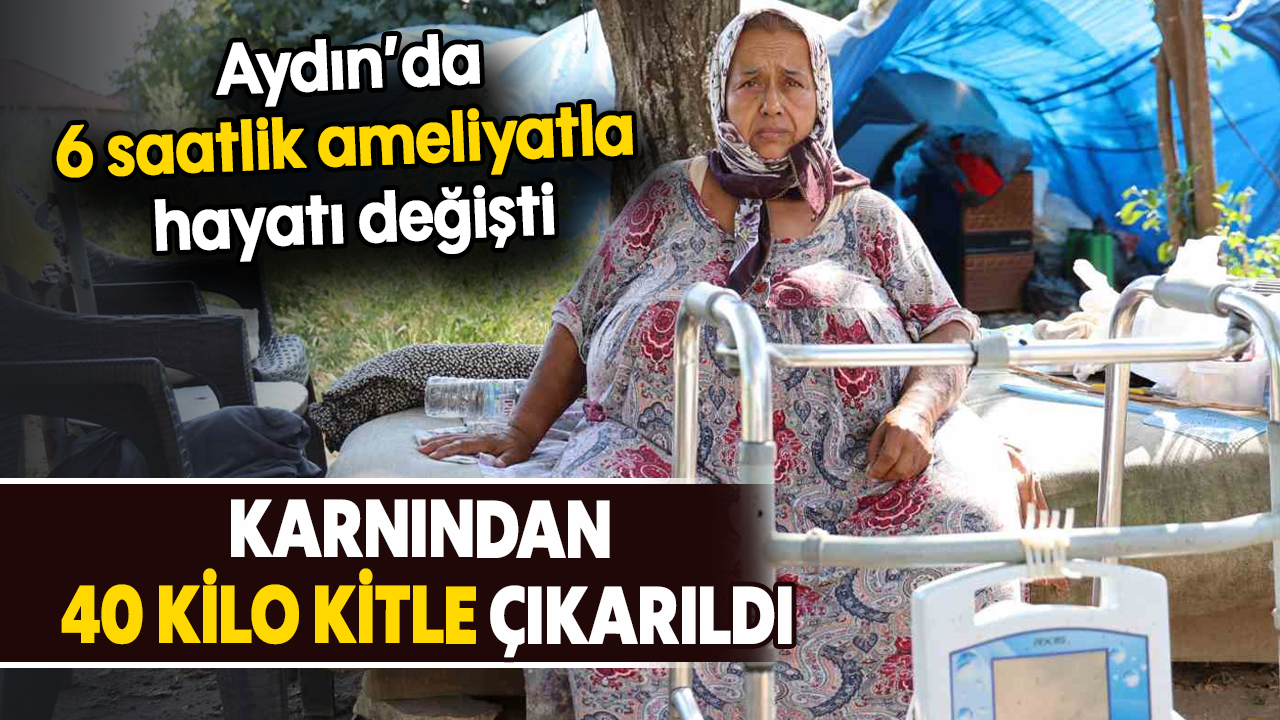 Aydın’da 6 saatlik ameliyatla hayatı değişti: Karnından 40 kilo kitle çıkarıldı